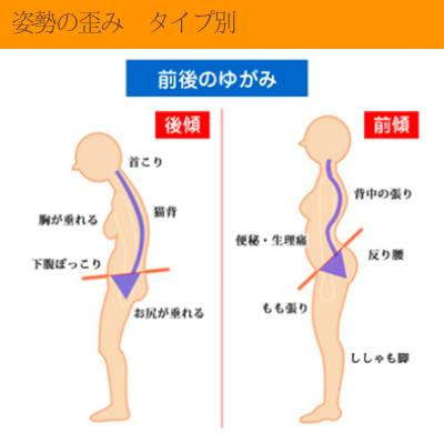 腰痛・肩こり対策のオーダーメイド枕にする為に 大阪 睡眠改善研究室は姿勢の歪みも測る1