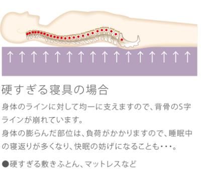 マットレスの有用性 大阪 睡眠改善研究室【硬い寝具の注意点】