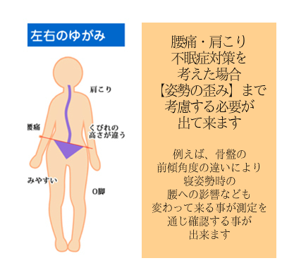 腰痛・肩こり対策のオーダーメイド枕にする為に 大阪 睡眠改善研究室は姿勢の歪みも測る2