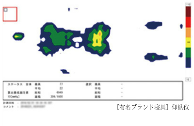 仰向き寝　腰痛対策マットレス【圧力図】