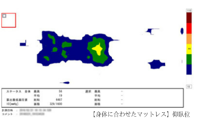 腰痛対策マットレスの睡眠時、圧力図