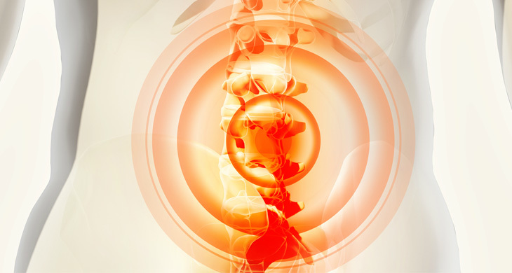 腰痛対策マットレスを姿勢ドクターが作成する