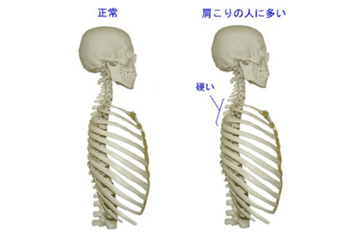 マットレスでの背中の痛み