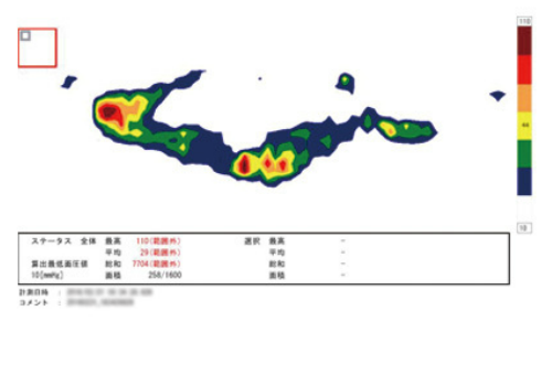 横向き寝での圧力数値