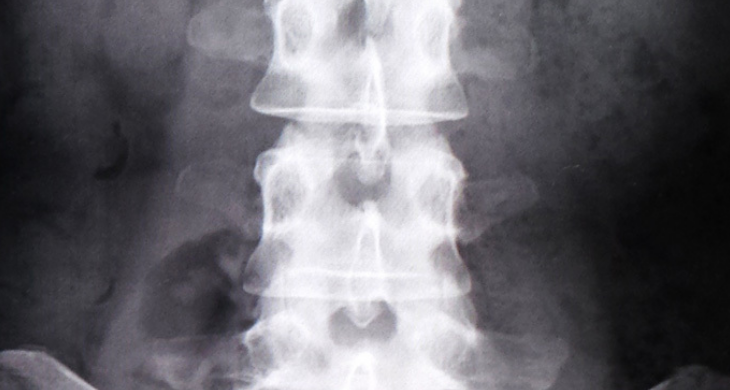 マットレス|腰痛対策へ