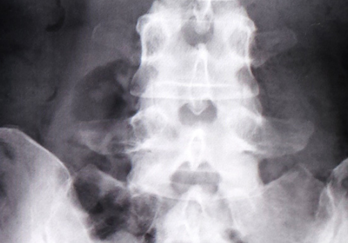 マットレスでの腰痛対策