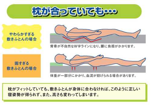 枕が合っていても